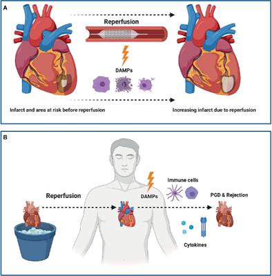 Damage-Associated Molecular Patterns in Myocardial Infarction and Heart Transplantation: The Road to Translational Success